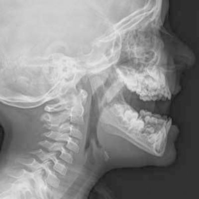 Radiografia Cavum Unimagem Radiografia Odontológica Curitiba