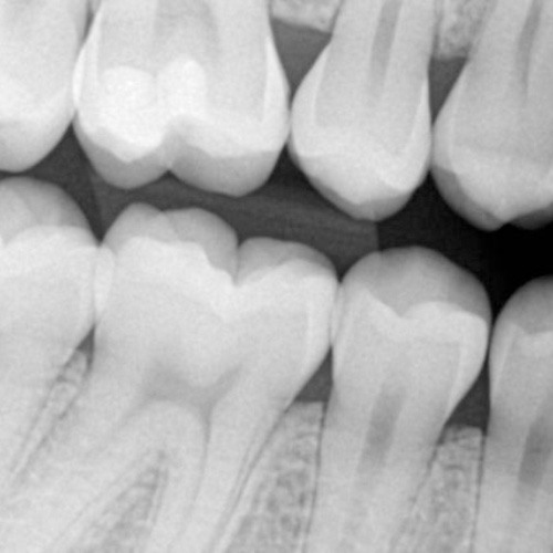 P.A. de Mandíbula - Unimagem Radiografia Odontológica Curitiba